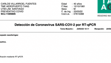 Positiver PCR-Test in Chile